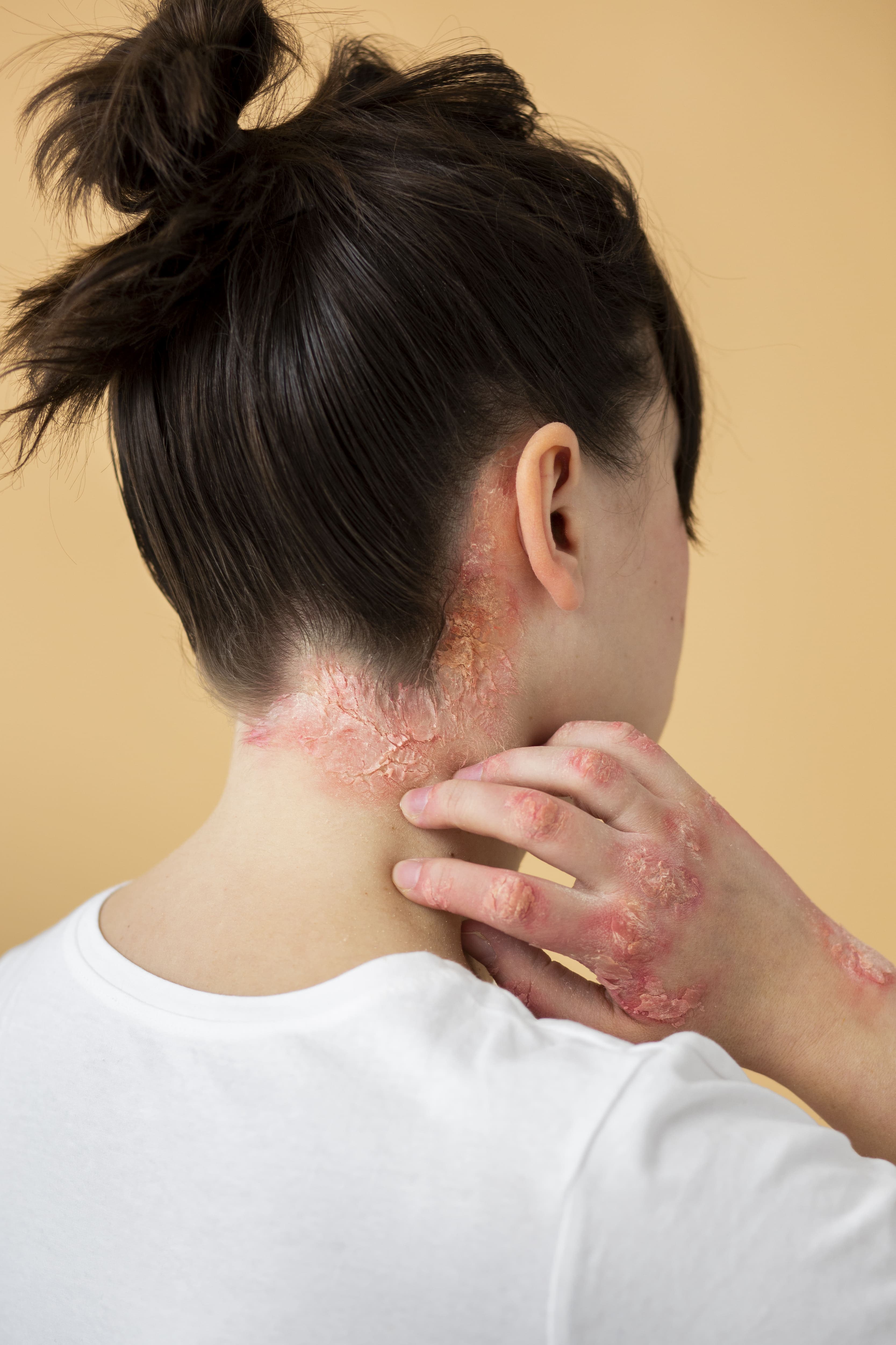 Skin Allergies & Conditions